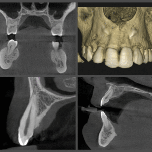 Interpretation of CBCT - What a dental practitioner should know? – via Zoom