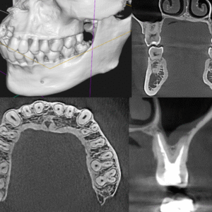 In Person Interpretation of CBCT – What a dental practitioner should know