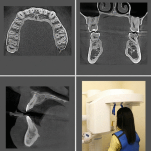 Pre-recorded Cone-beam Computed Tomography Licensing (DEN4, IA24) + In Person Interpretation of CBCT – What a dental practitioner should know Combo Course