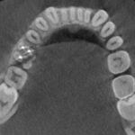 cbct