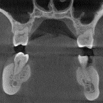 cbct
