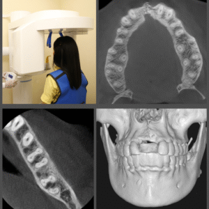 Pre-recorded Cone-beam Computed Tomography Licensing (DEN4, IA24) + Interpretation of CBCT – What a dental practitioner should know? – via Zoom Combo Course