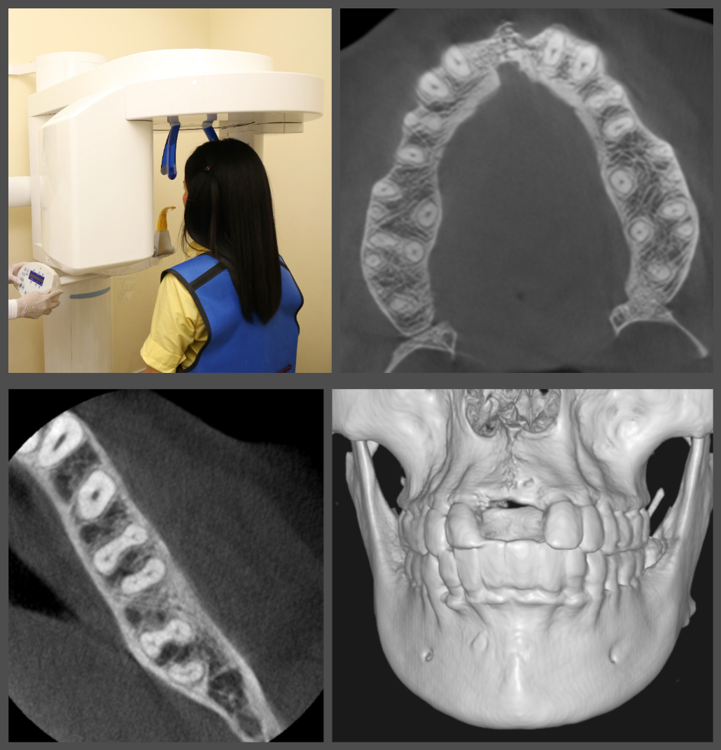 Pre-recorded Cone-beam Computed Tomography Licensing (DEN4, IA24) + Interpretation of CBCT – What a dental practitioner should know? – via Zoom Combo Course