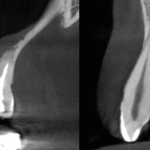 Pre-recorded Cone-beam Computed Tomography Licensing (DEN4, IA24) + In Person Interpretation of CBCT – What a dental practitioner should know Combo Course