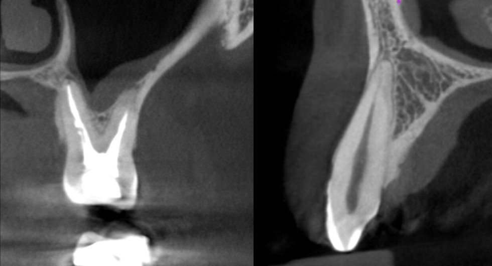 Pre-recorded Cone-beam Computed Tomography Licensing (DEN4, IA24) + In Person Interpretation of CBCT – What a dental practitioner should know Combo Course