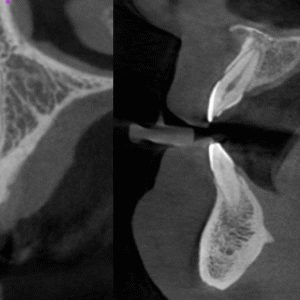 Pre-recorded Cone-beam Computed Tomography Licensing (DEN4, IA24) + Interpretation of CBCT – What a dental practitioner should know? – via Zoom Combo Course