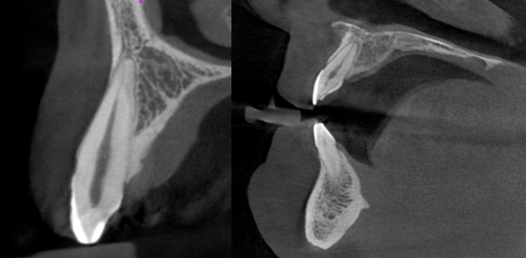 Pre-recorded Cone-beam Computed Tomography Licensing (DEN4, IA24) + Interpretation of CBCT – What a dental practitioner should know? – via Zoom Combo Course